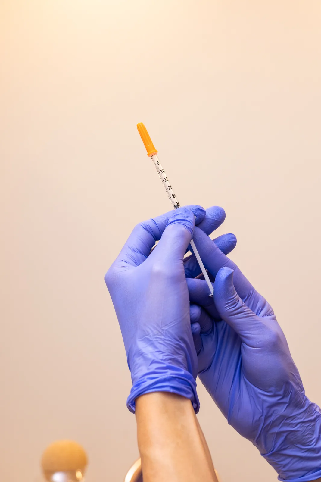 Manos con guantes de nitrilo sosteniendo una jeringa de mesoterapia sobre fondo claro